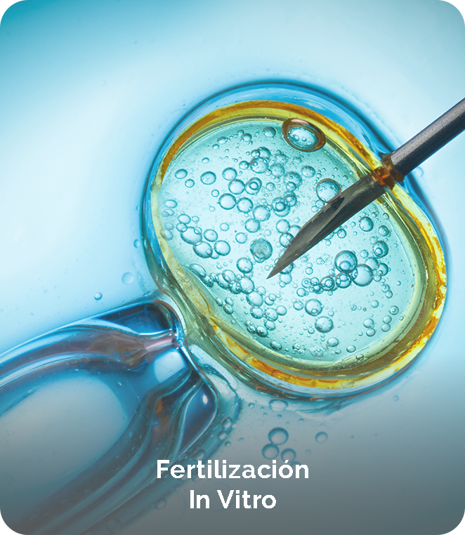 fertilizacion in vitro