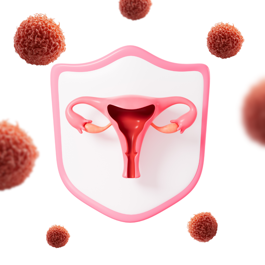 Tratamiento de Miomas uterinos Queretaro
